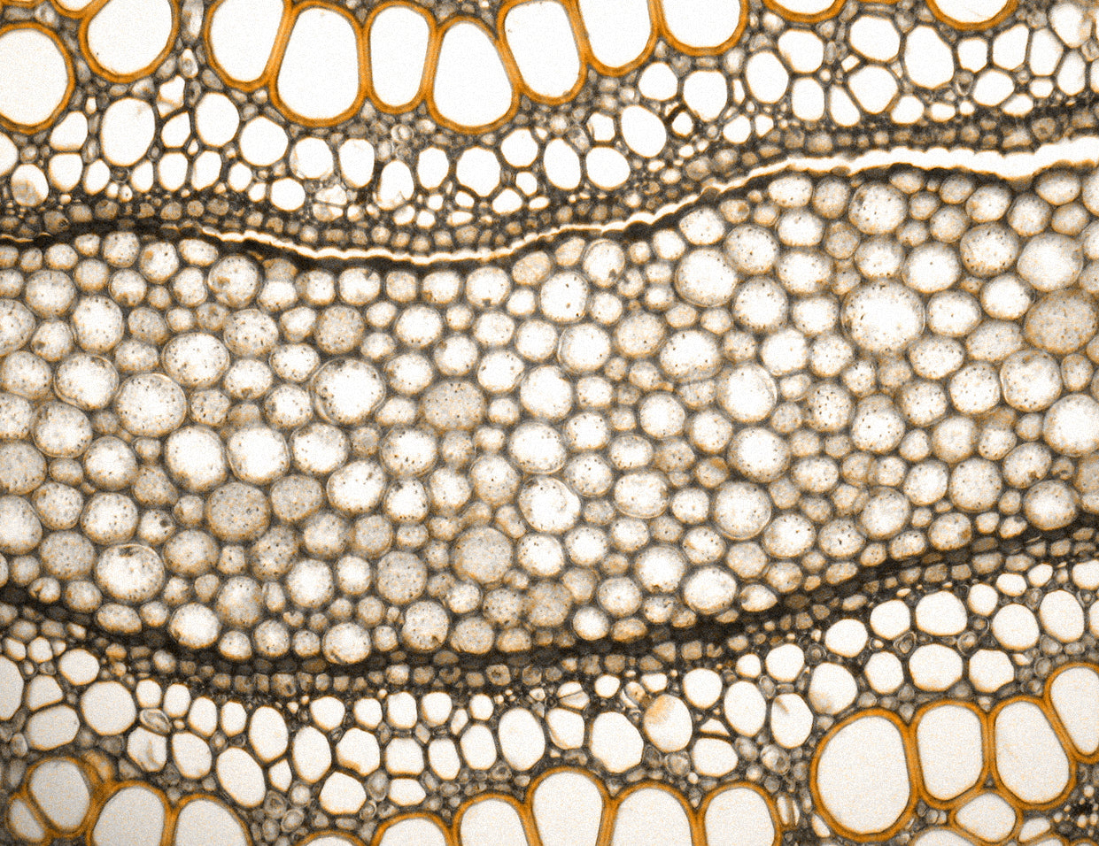skin barrier