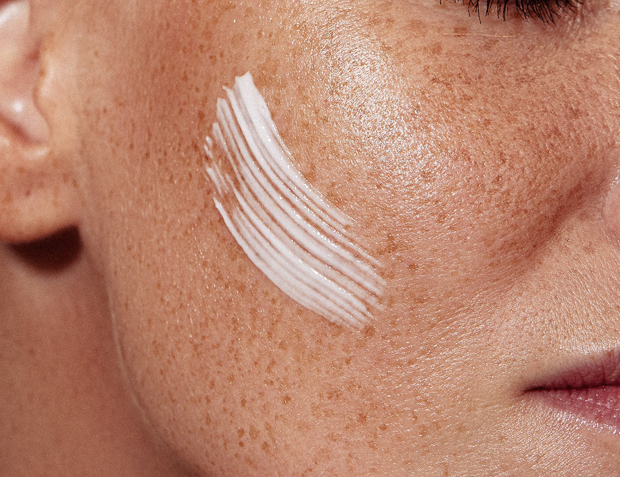 skin barrier support