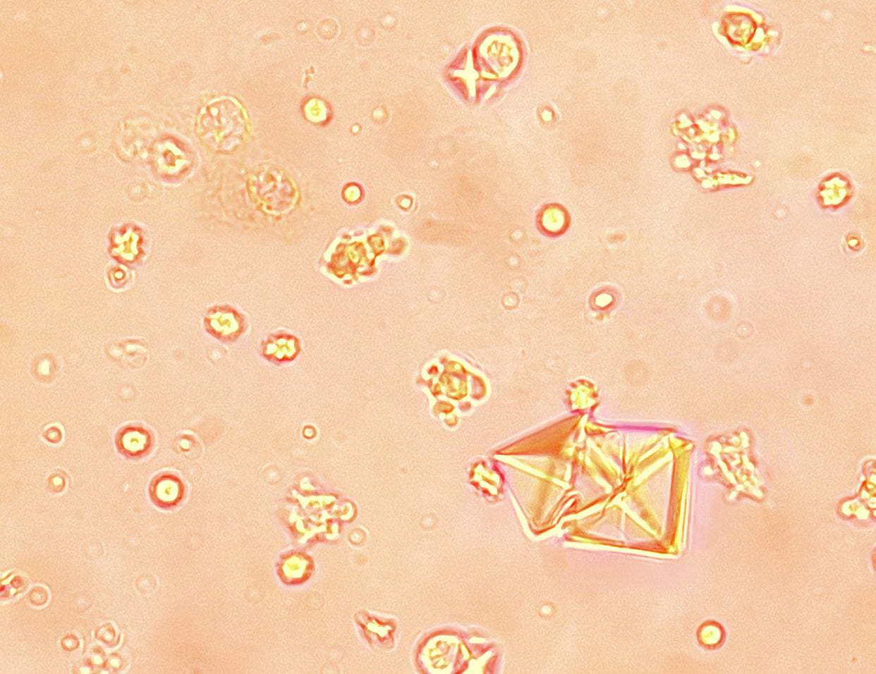 hydroxysomes retinaldehyde
