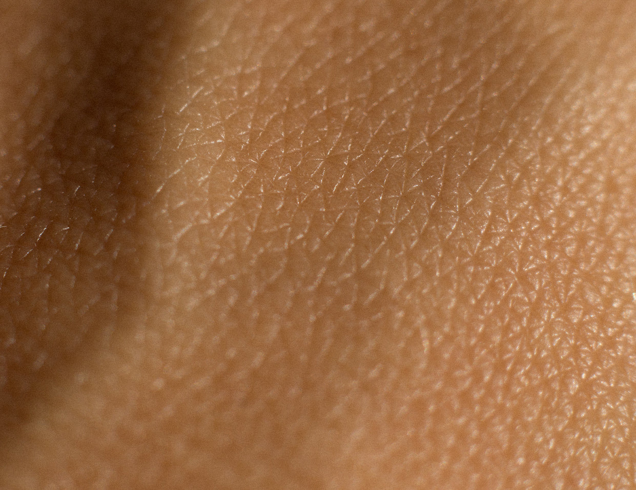 combination skin type