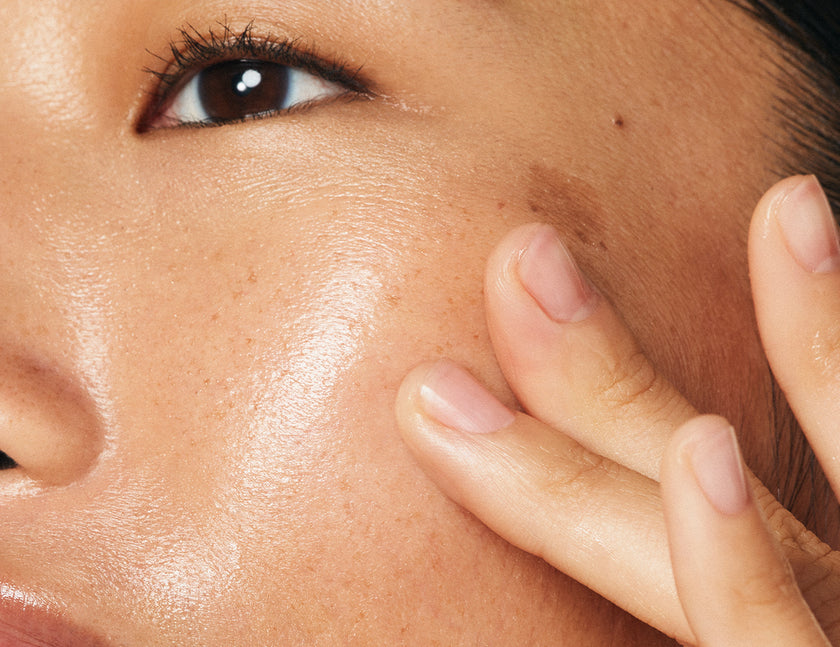 Cosmetic Ingredients That Help With Dark Spots Prequel