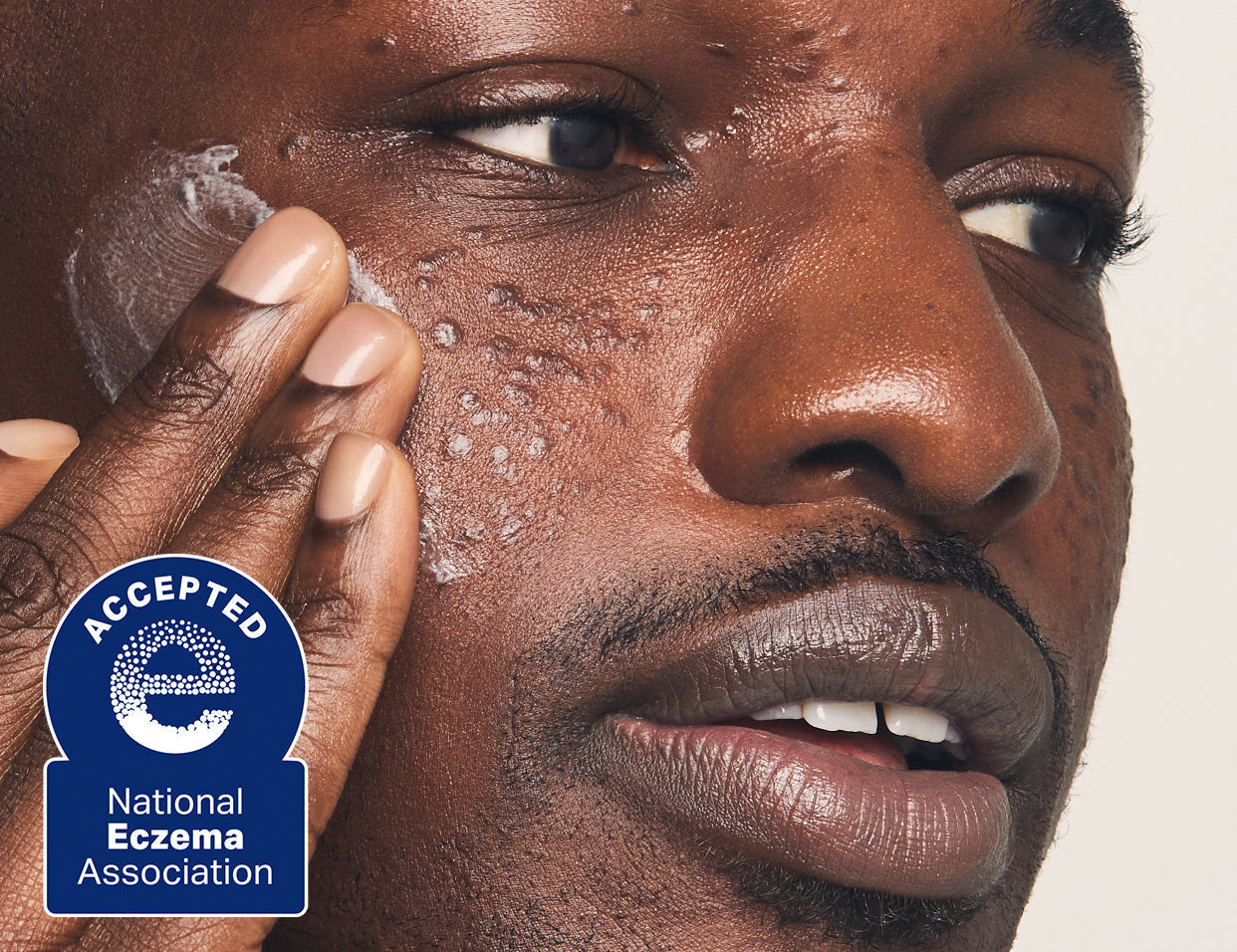 skincare for eczema