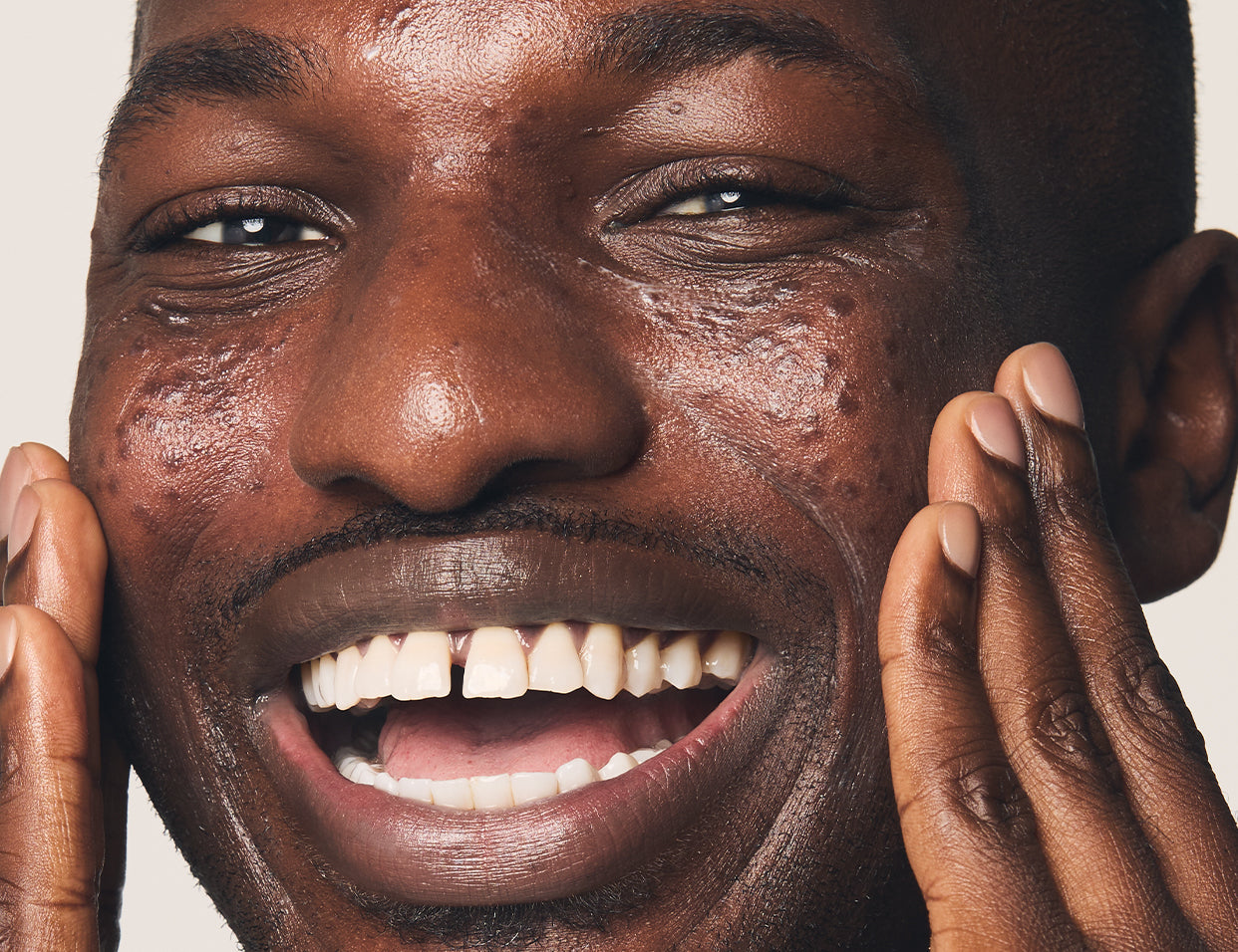 skincare for dry skin